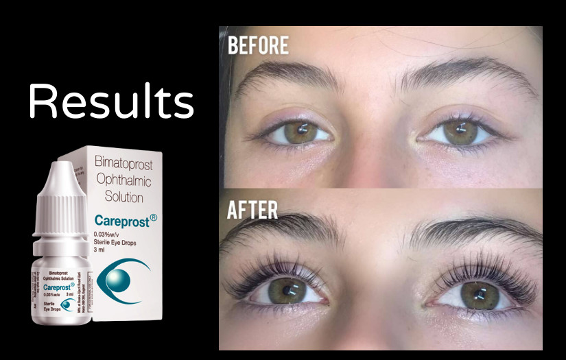 article cover - How To Regrow Eyelashes Within a Week?