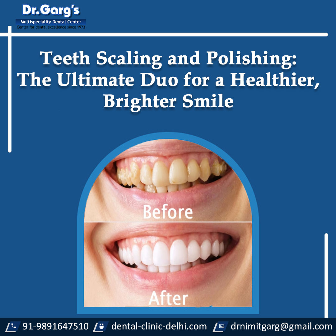 article cover - Teeth Scaling and Polishing: The Ultimate Duo for a...