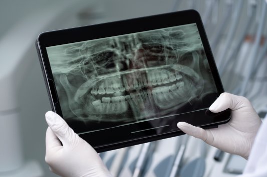 article cover - Dental Imaging Market Insights, Trends, and Growth...