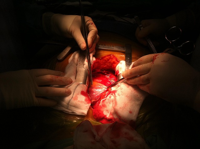 article cover - Cardiovascular Surgery: Restoring Heart and Vascular Health